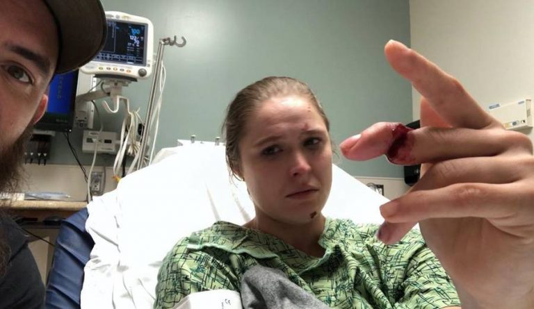 Ronda Rousey casi pierde un dedo en un accidente durante un rodaje